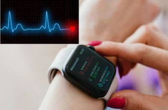 Mejor reloj ecg